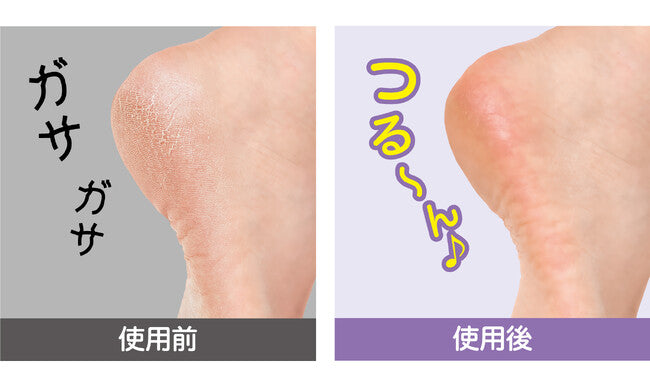 日本Cellsh角質細毛清除器