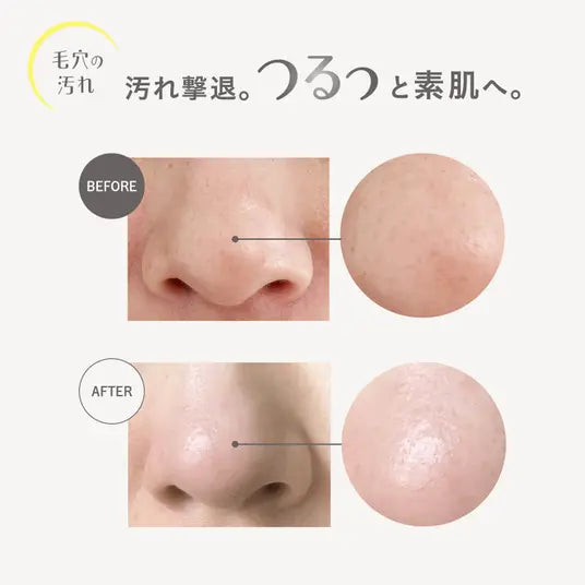 🧴 Capsule Serum膠囊精華卸妝油V|雙層毛孔清潔 × 維他命C卸妝(2026新品)