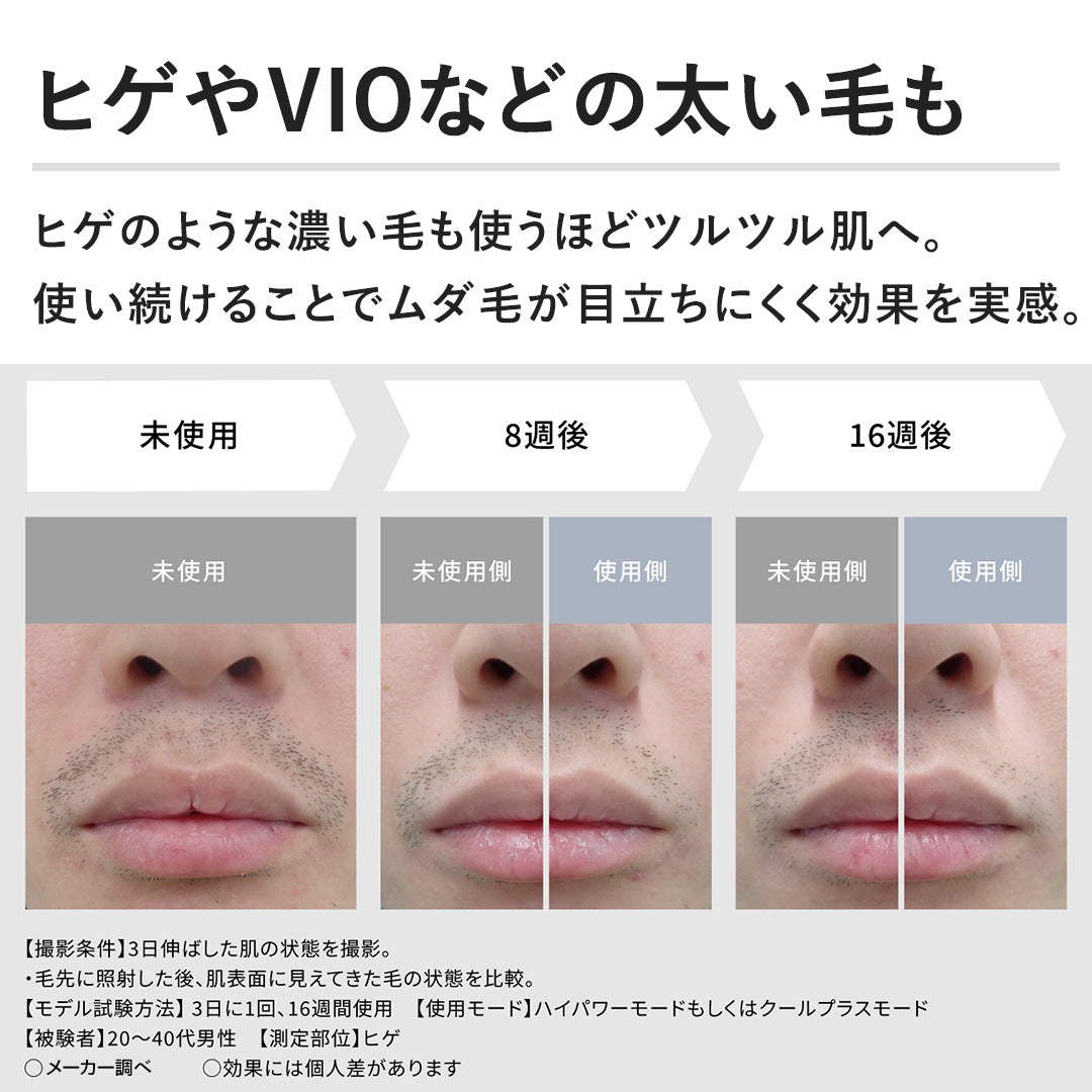 Panasonic ES-WG0B-H 光美容器|Smooth Ep Power & Cool 冷卻脫毛儀(VIO/臉部可用)